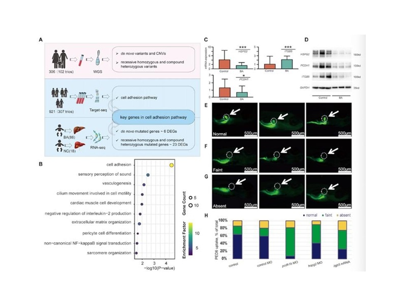 上海交大Bio-X研究院秦胜营团队与合作者揭示细胞黏附通路异常为胆道闭锁核心发病机制
